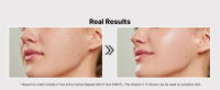 skin irritation test real results used on all skin types sensitive skin hript clinically tested