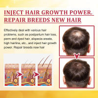 El líquido de crecimiento nutre, reafirma, solidifica el cabello, mejora la reparación, fortalece las raíces y previene la caída del cabello. - details 7