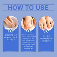 Solución para el cuidado de las uñas, Esencia para el cuidado de los hongos, Eliminación de la tiña, Gel antimicótico - details 8