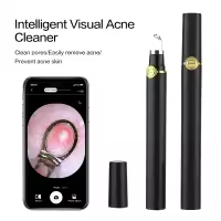 Aguja Visual inteligente para el acné, dispositivo de eliminación de acné Facial, limpieza de poros, instrumento de belleza, carga USB - details 2