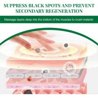 Suero corrector de manchas oscuras, crema blanqueadora hidratante para la piel Facial, Reduce las pecas, la opacidad, el acné y la melanina - details 8