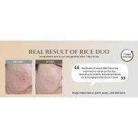 Tónico facial de arroz que reabastece el brillo, cuidado hidratante coreano para pieles grasas y mixtas - details 3