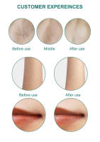 Depilador Láser de Cristal de Zafiro Vancostar con 8 Modos Funcionales para Mujeres y Hombres Epilador IPL Permanente Sin Dolor y Enfriamiento - details 19