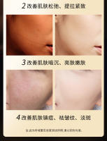 Nuevo Instrumento de Belleza Ultrasónico Reafirmante y Levantador de Microcorriente EMS Facial - details 7