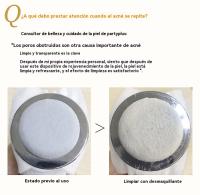 radiofrecuencia facial Súper pulso de alta frecuencia, instrumento de radiofrecuencia EMS microcorriente ojo desvanecimiento líneas finas levantamiento - details 5