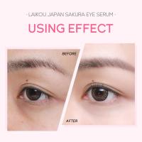 Set de Cuidado de la Piel de Sakura Crema Facial, Serum, Toner, Limpiador de la Piel, Crema de Ojos, Hidratante Blanqueador - details 15