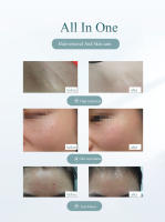 IPL hair removal laser epilator women photo facial hair remover body epilator laser threading machine legs men depilation device - details 7
