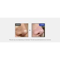 microneedle, Zero exosome shot, Lacto exosome, instant pore-tightening care, Pore Refining serum