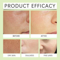 El limpiador exfoliante de árbol de té limpia las manchas de grasa facial, hidrata y suaviza la piel sin apretar, cuidado suave. - details 5