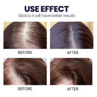 Spray hidratante para el cuidado del cabello, seco y rizado, fortalecedor y mejorador - details 7