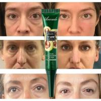 Crema para ojos de aguacate, eliminación de ojeras, bolsas para los ojos, hinchazón, cremas hidratantes antiarrugas para los ojos, productos para el cuidado de la piel - details 0