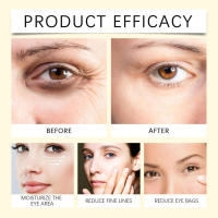 Eye Light, Moisturizing, Elastic, Tender Skin Massage, Nourishing And Moisturizing Essence - details 8