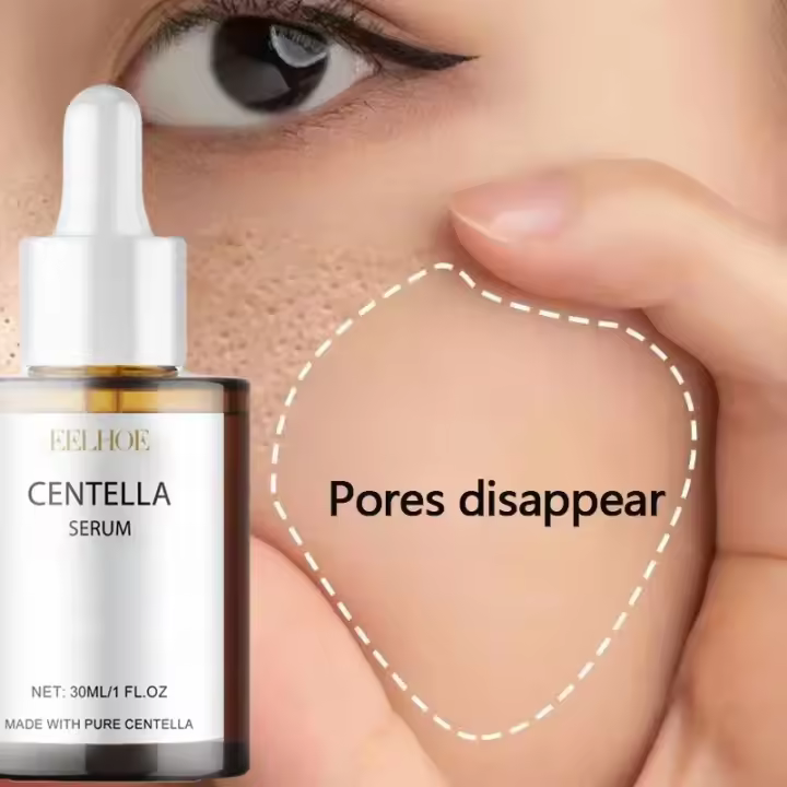 Suero Facial Centella Asiatica que nutre la piel seca, rejuvenece la piel, crema blanqueadora, crema hidratante Facial coreana - 1