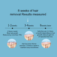 Professional women epilator laser female ipl hair removal laser pulsed light face body photoepilator electric depilation device - details 1
