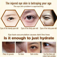 Suero para ojos para eliminación de gránulos de grasa, antiojeras, bolsas para ojos, se desvanecen, esencia de línea fina, antihinchazón, productos hidratantes para el cuidado de la piel - details 2