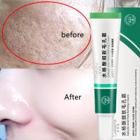 Crema Reductora de Poros de Ácido Salicílico Adiós a los Pulgares, Reparación de Piel, Estiramiento - details 11