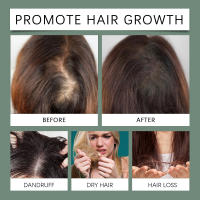 HOEGOA Folículos de aceite de romero, hidrata el cabello, nutre el cuero cabelludo, irradia brillo al cabello - details 11