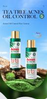 Loción para el acné del árbol del té, cuidado facial antiacné, crema hidratante de día y de noche para mujeres y hombres - details 1
