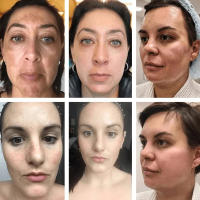 Crema Ligera para Iluminar la Piel de Niacinamida Debilita el Melasma, Desvanece Manchas Fine, Ilumina Piel Oscura Herramientas de Cuidado de la Piel Facial - details 1