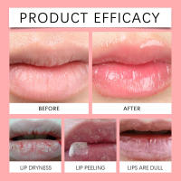 El lápiz labial protector El ácido hialurónico protege, hidrata, suaviza y mejora la piel seca de los labios - details 10