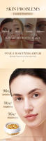 Sérum Facial, Esencia de Caracol y Rosa, Suero para Hidratar y Nutritiva, Crema ideal para la piel del rostro - details 2