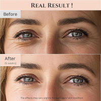 Joseon Revive utiliza niacinamida retiniana para corregir los ojos con suero para ojos - details 2
