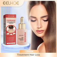 Esencia para tratamiento del cuero cabelludo, tratamiento anticaspa para psoriasis, alivia la descamación, la picazón, potenciador de folículos, suero nutritivo para el cabello - details 2
