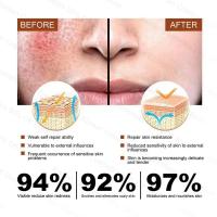 Crema de día correctora antienrojecimiento Facial, crema para el cuidado de la piel sensible a la picazón, crema hidratante para iluminar la Base, cosméticos - details 7
