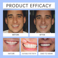 Mejora la estética de la sonrisa, conjunto de dientes cosméticos de dentadura de material cómodo - details 10