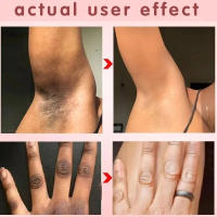 Crema blanqueadora corporal, blanqueador rápido, partes privadas, aclara las axilas, piernas, rodillas, melanina, áreas íntimas, elimina las manchas, belleza y salud - details 0
