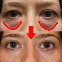 Crema de Ojos de Retinol Eliminación Inmediata de Ojeras Desvanecimiento de Líneas Finas - details 4