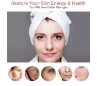 Dispositivo de electroporación Led para estiramiento de piel, máquina de belleza para el cuidado facial, EMS/RF, uso doméstico - details 0
