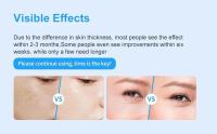 EMS-máquina de estiramiento de la piel Facial, terapia de calor por radiofrecuencia, moldeador corporal, instrumento de masaje ocular - details 3