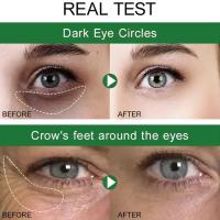 Crema para ojos para apretar arrugas, 7 días, línea fina, blanquea la piel debajo de los ojos, cuidado coreano, antiojeras, bolsas, hinchazón, se desvanece, nuevo 2024 - details 2