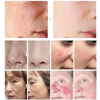 Crema Reparadora para Rojos Hidratante y Calmante para Piel Sensible Adiós a la Piel Seca - details 5