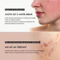 Centella Asiatica ampolla esencia hidratante alivia la inflamación de la piel calmante suave alivia la sequedad cuidado de la piel Facial - details 11