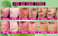 Color Correcting Treatment