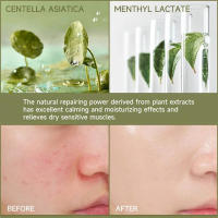 Suero reparador de enrojecimiento Facial, mejora la sequedad de la piel sensible, loción hidratante, eliminación de rosácea, Cosméticos Coreanos - details 9
