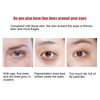 Crema Antideslumbramiento para Ojos Serum Antiedad para Eliminar Ojeras, Cirros, Hinchazón - details 1