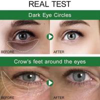 Crema para ojos de aguacate, eliminación de ojeras, bolsas para los ojos, hinchazón, cremas hidratantes antiarrugas para los ojos, productos para el cuidado de la piel - details 1