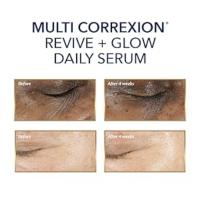 RoC Vitamin C Serum Before and After