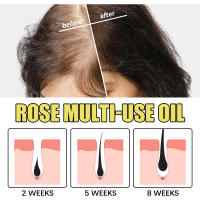 El pétalo de rosa hidrata la piel del cuerpo, protege el cabello y los pies de grietas, aceite esencial de cuidado multiefecto - details 7