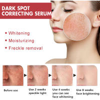 Sérum Facial Coreano Niacinamida Ilumina la Piel, Rejuvenece, Hidrata, Blanquea, Desvanece Manchas y Líneas Finas Herramienta de Cuidado de la Piel de Belleza - details 3