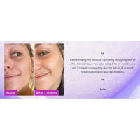 Before and after 3 months