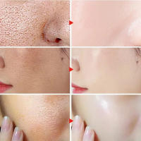 Crema Reductora de Poros de Ácido Salicílico Eliminación Rápida de Pimientas Piel Suave y Lisa - details 6