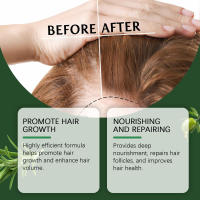 El romero promueve un crecimiento saludable y nutritivo, aceite esencial resistente para el crecimiento del cabello - details 7