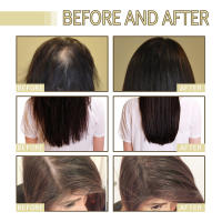 Aceite esencial de romero para reparar, suavizar, nutrir y brillo el cabello - details 7