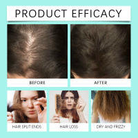 El spray para el cuidado del cuero cabelludo con romero nutre suavemente y repara el cabello fuerte, flexible, brillante y radiante - details 7