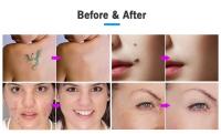 Pluma de escaneo de manchas de plasma y lunares, dispositivo de belleza antibacteriano y reductor de acné para el cuidado facial con ozono - details 6