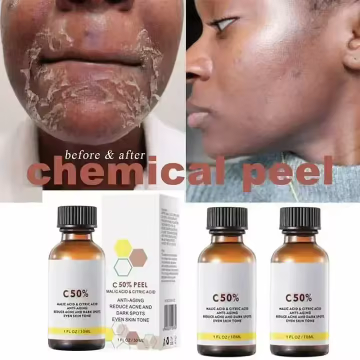 Cuidado facial Exfoliante Piel radiante Desvanece las manchas oscuras y la pigmentación para una piel aún más brillante Elimina las manchas Brazo Rodilla Piernas Melanina - 1